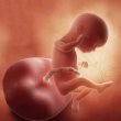 ارزیابی مرگ جنین