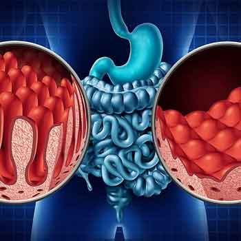 مدفوع چرب چیست؟