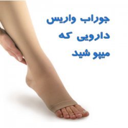 واریس چیست | علائم و درمان بیماری واریس پا