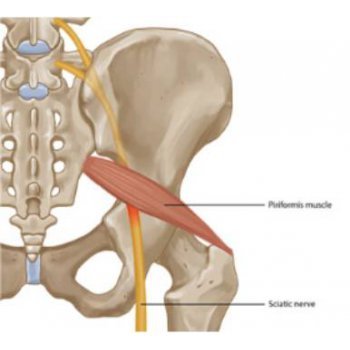 سندرم پیریفورمیس چیست؟