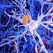 سلول های ایمنی مغز و آلزایمر