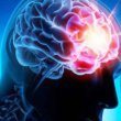 علائم اولیه تومور مغزی چیست؟